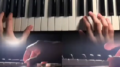 Turn to You